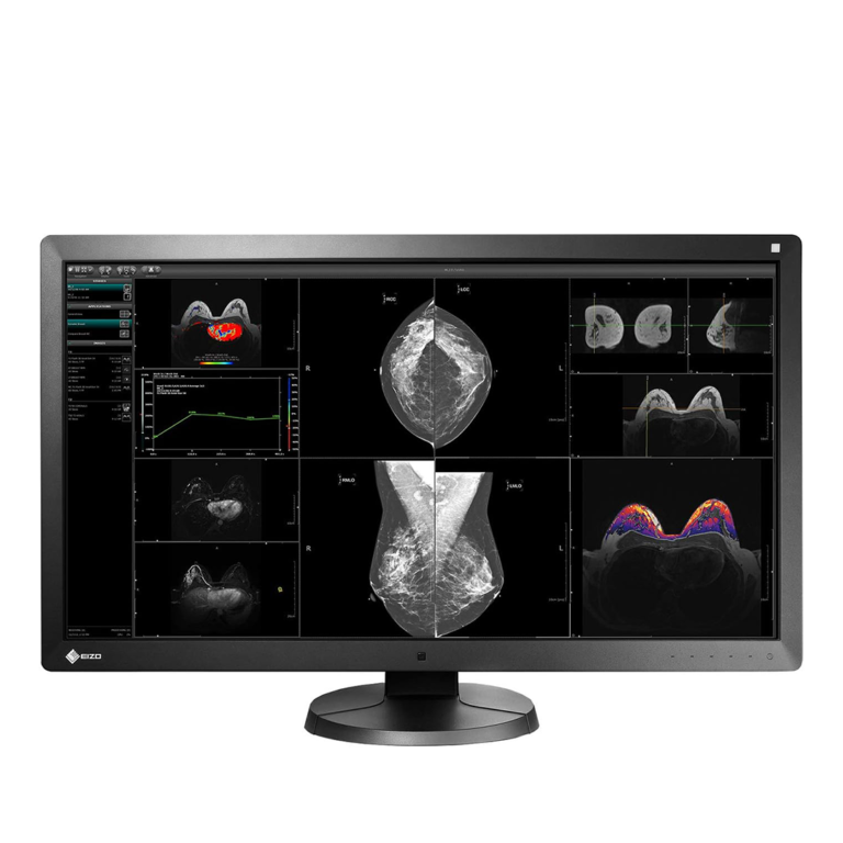 Monitores grado médico