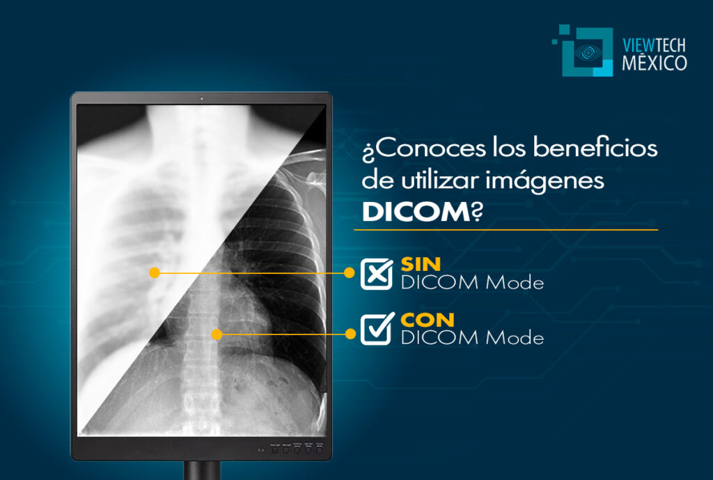 Monitores grado médico