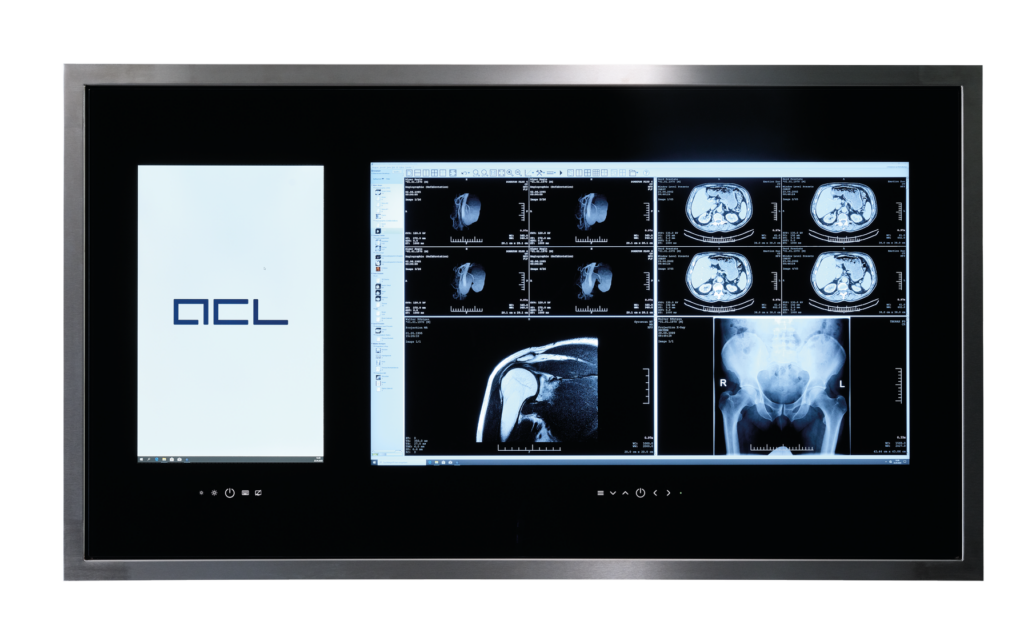 ACL OR-CONSOLE