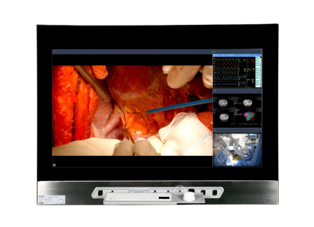 MDMX-25500 GNNB